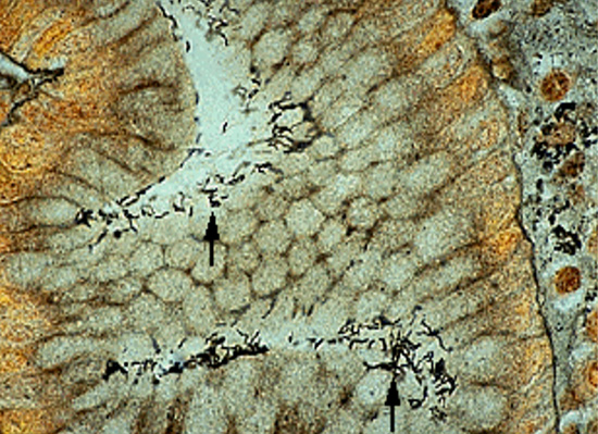 Imagen microscópica de Helicobacter pylori con tinción de plata.